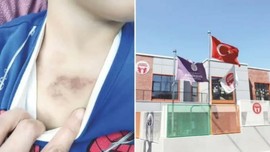 İBB kreşindeki istismar ve darp skandalında şoke eden ayrıntılar! Çıplak kameraya çekmiş