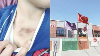 İBB kreşindeki istismar ve darp skandalında şoke eden ayrıntılar! Çıplak kameraya çekmiş