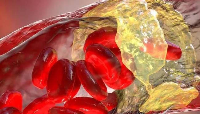 Harvardlı doktorlar açıkladı! - Resim : 1